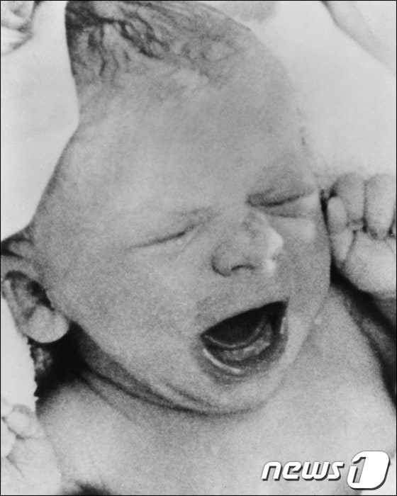최초의 시험관 아기 루이스 브라운(자료사진). ©AFP=News1