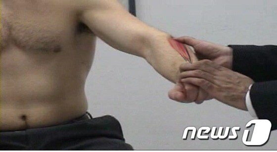 오른손 엄지로 누르고 있는 팔꿈치 부위가 테니스 엘보우의 통증 부위로 근육과 함께 3D영상화하여 표현 모습./사진제공=조선대병원 © News1