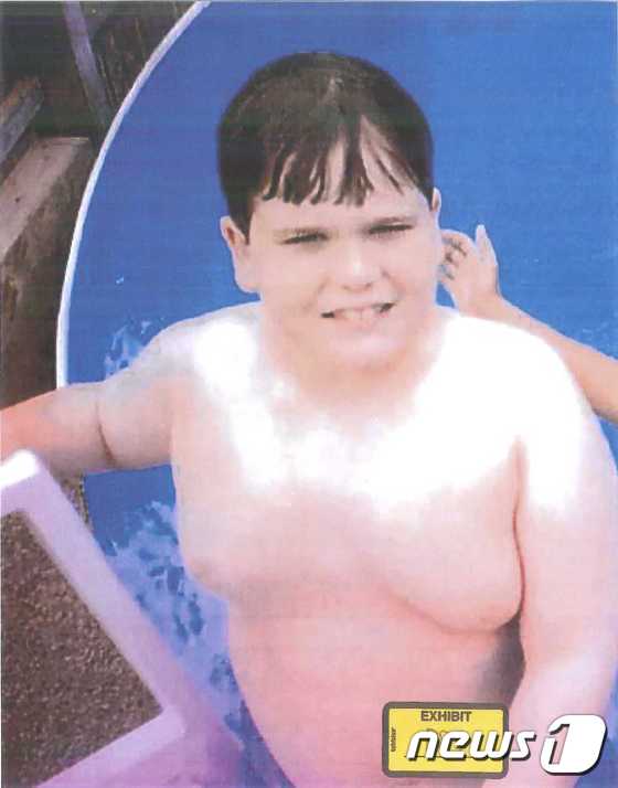 여성유방증을 앓고 있는 오스틴이 수영장에서 물놀이를 즐기고 있다. 당시 그의 나이 10세(출처 : 허핑턴포스트). /뉴스1 © News1