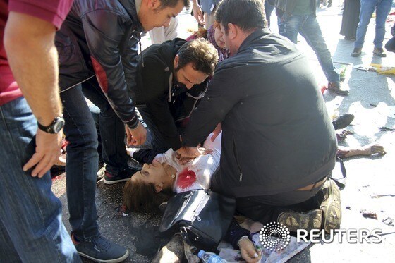 터키 수도 앙카라에서 10일(현지시간) 대규모 자살 폭탄 공격이 발생했다. 이 사건으로 큰 부상을 입은 한 여인을 구하기 위해 사람들이 응급조치를 취하고 있다.