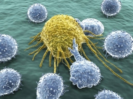 무시하기 쉬운 암 증상 10가지