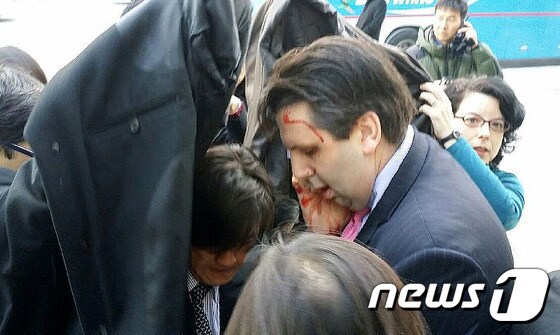 흉기 피습을 당한 마크 리퍼트 주한미국대사. /뉴스1 © News1