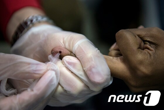 에이즈 테스트. © AFP=News1