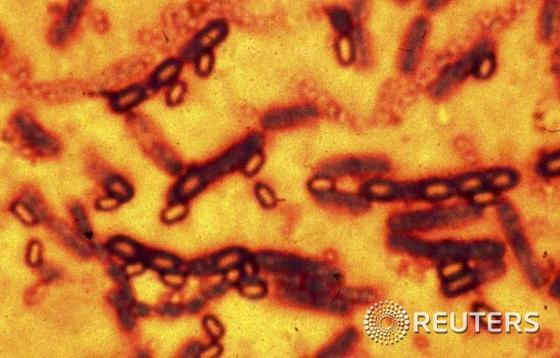 현미경으로 본 탄저균의 모습.© 로이터=뉴스1