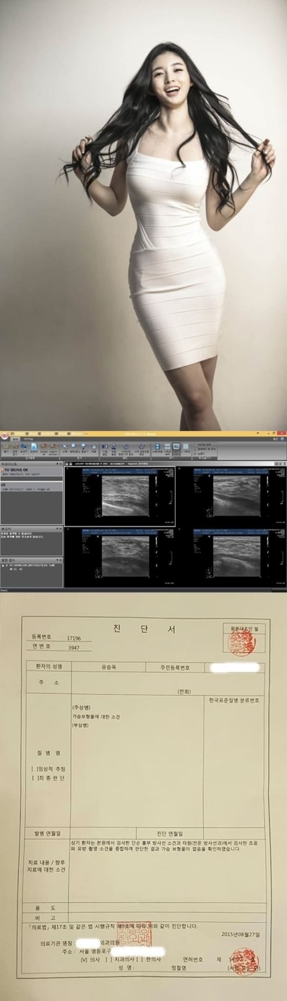 유승옥 측이 가슴수술 의혹을 해명하기 위해 CT 촬영본을 공개했다. © News1스포츠 / 프로페셔널 엔터테인먼트
