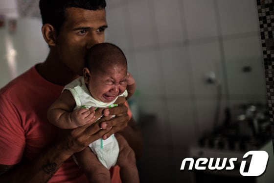 엘살바도르에서 지카바이러스 감염증에 감염된 소두증 신생아가 울음을 터뜨리고 있다./© AFP=뉴스1