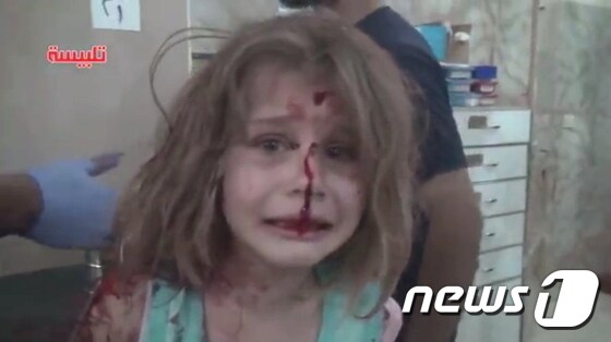 시리아 탈비세 공습으로 부상당한 8세 소녀 '아야'가 얼굴에 피를 흘리며 울고 있다. © News1