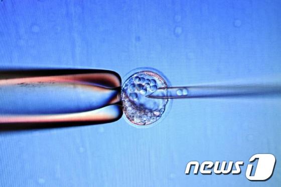 광학현미경으로 바라본 유전자 편집 과정©AFP= News1
