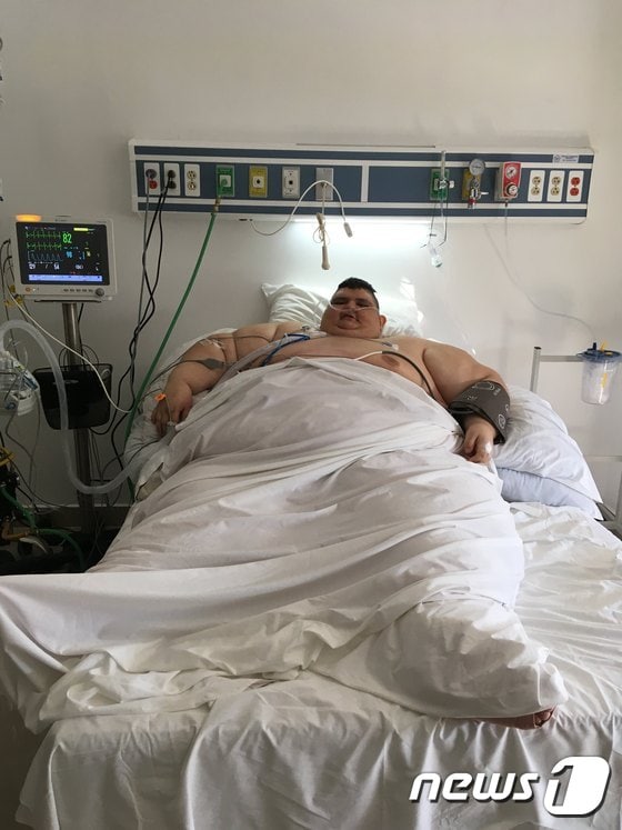 23일(현지시간) 세계에서 가장 뚱뚱한 남자 후안 페드로 프랑코(33)가 두 번째 위 절제술을 받고 멕시코의 한 병원에서 회복하고 있다. © AFP=뉴스1