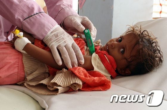 콜레라에 감염된 것으로 보이는 예멘 아동이 병원에서 진료를 받고 있다. (자료사진) © AFP=뉴스1