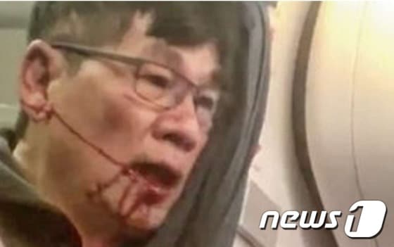 입에서 피를 흘리고 있는 유나이티드항공 사건의 피해자 - 웨이보 영상 갈무리 ©News1