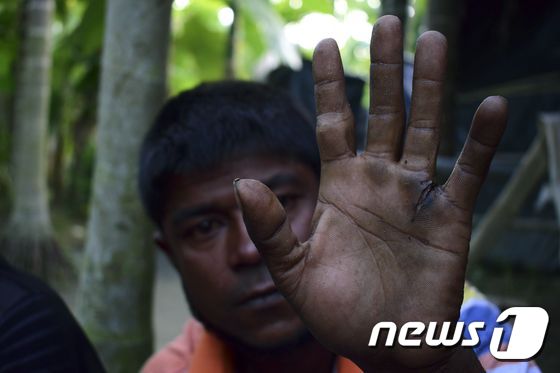 지난해 미얀마군에 폭행당한 흔적을 보여주는 로힝야족. © AFP=뉴스1