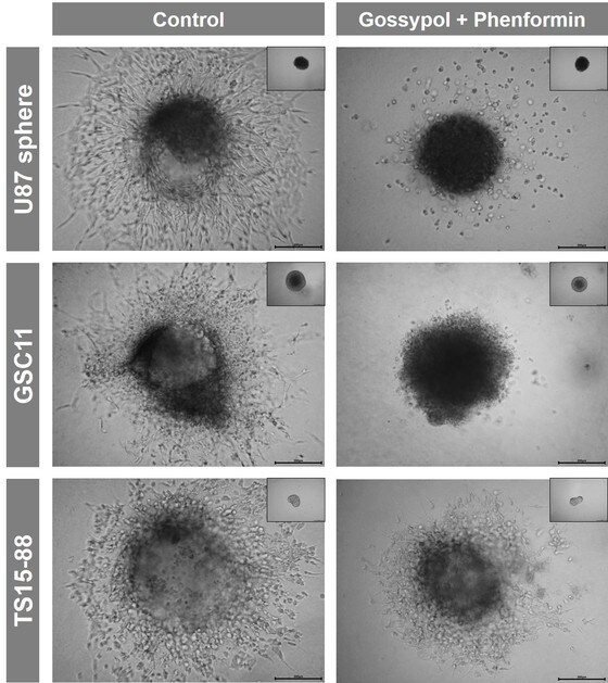 교모세포종 암세포(U87sphere, GSC11, TS15-88)에 고시폴과 펜포르민 병용 투여한 경우 일어나는 세포 변화© News1