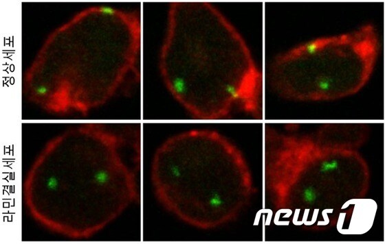 라민 결실 세포에서 특정 DNA가 세포핵막으로부터 분리되고 있다.(한국연구재단 제공)© News1