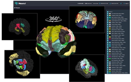 3D 뇌영상 분석 결과(과기정통부 제공)
