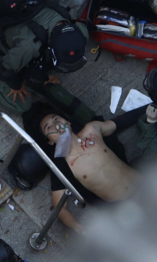 1일 홍콩 도심에서 열린 반정부 시위에서 18세 소년이 경찰이 쏜 실탄에 맞고 쓰러졌다. 그는 병원으로 이송돼 수술을 받았지만 현재 중태인 것으로 알려진다.(출처 = 조슈아 웡 트위터) © 뉴스1