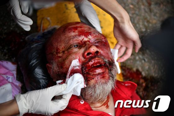 시위 군중을 향해 차를 몬 택시기사가 일부 시위대에 폭행당한 뒤 의료진의 치료를 받고 있다. © AFP=뉴스1