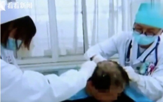 병원 의료진이 환자의 머리를 삭발하고 있다 - 칸칸뉴스 갈무리