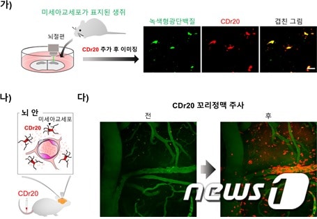 알츠하이머 동물모델 뇌의 미세아교세포를 CDr20으로 관찰한 모습(IBS 제공)© 뉴스1
