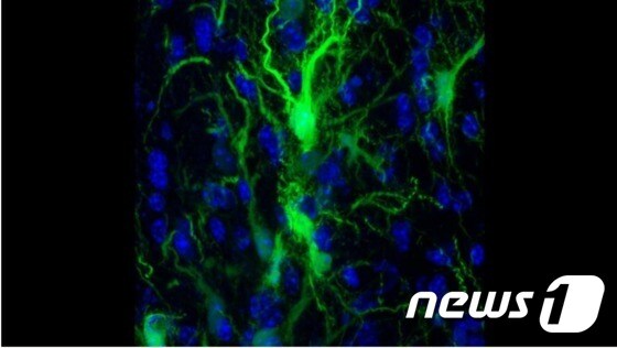 연구진은 생쥐 뇌에 이식한 신경아교세포의 생존 및 활성화 여부를 판단하기 위해 특수 카메라로 관찰했다. (사진출처=존스홉킨스 병원 홈페이지)© 뉴스1