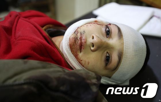 11일 시리아 이들리브주에서 발생한 정부군 공습으로 부상을 입은 어린아이의 모습. © AFP=뉴스1