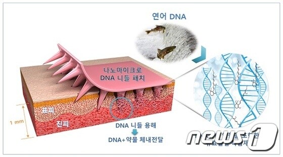 통증 없이 붙이는 주사-나노마이크로 DNA 니들패치© 뉴스1