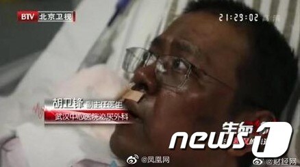 코로나19 환자들을 돌보다 얼굴이 까맣게 변했던 후웨이펑 의사-웨이보 갈무리