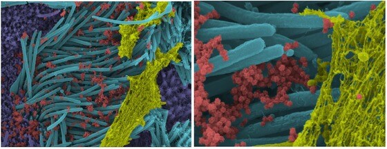 기도의 점액(노란색) 안에 있는 감염된 섬모 세포(파란색)에 붙어있는 코로나19 바이러스(빨간색)가 밀집돼 있는 모습을 확인할 수 있다.  위의 사진은 연구실에서 보기 편하도록 색을 보정했다.  (사진출처=미 노스캐롤라이나대학교 의과대학 홈페이지 갈무리)© 뉴스1