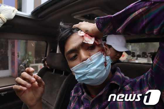 미얀마 제2도시 만달레이에서 2021년 2월 20일 군부 쿠데타 항의 시위에 참가한 한 남성이 군·경의 강경 진압으로 머리에 부상을 입고 피 플리는 모습. © AFP=뉴스1 © News1 최서윤 기자