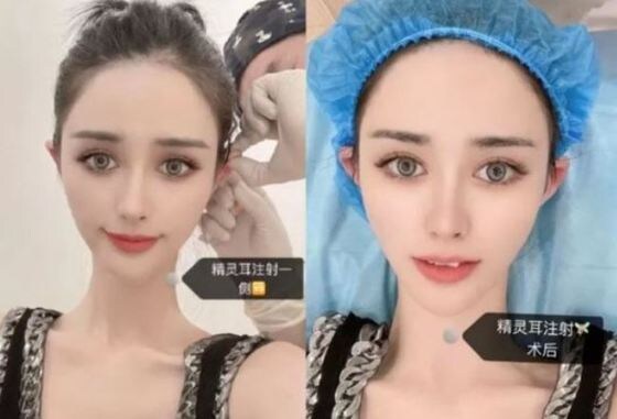 중국에서 큰 인기를 끌고 있는 '엘프 귀'를 가진 여성. (웨이보 갈무리) © 뉴스1