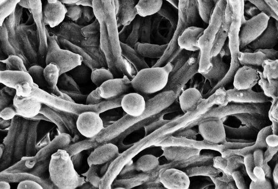 장내에 서식하는 칸디다 알비칸스(Candida albicans) 곰팡이의 병원성 균사 모습, 전자현미경(SEM)으로 촬영. (©Vader 1941) 2021.07.15/뉴스1