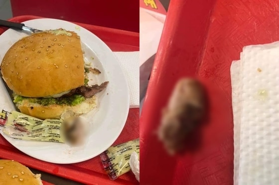 볼리비아의 한 햄버거 체인점에서 손님이 먹던 햄버거에서 사람 손가락이 나왔다. (트위터 갈무리) © 뉴스1