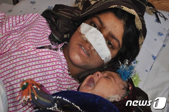 아프가니스탄 한 여성이 남편에 의해 코가 잘려 붕대를 감은 채 아이와 누워있다. (본문과 관련없음) 2016.01.19 © AFP=뉴스1