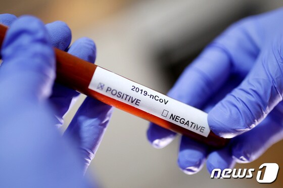신종 코로나바이러스 감염증(코로나19) 양성 샘플. © 로이터=뉴스1 © News1 정윤영 기자