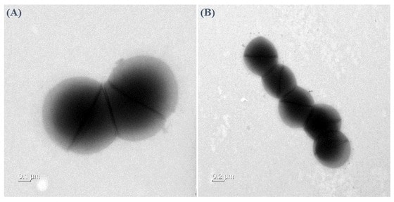 '아르세니시코쿠스 카우애(Arsenicicoccus cauae)' 전자현미경 사진(사진제공=중앙대병원) © 뉴스1