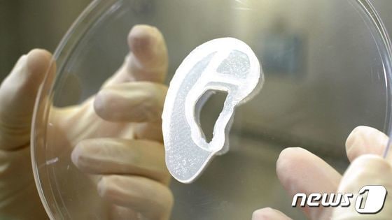 미국 의료 기업 3D Bio Therapeutics가 3D 프린팅 기술로 만든 생체 이식용 귀. 2022.06.03/뉴스1 © AFP=뉴스1 © News1 김민수 기자