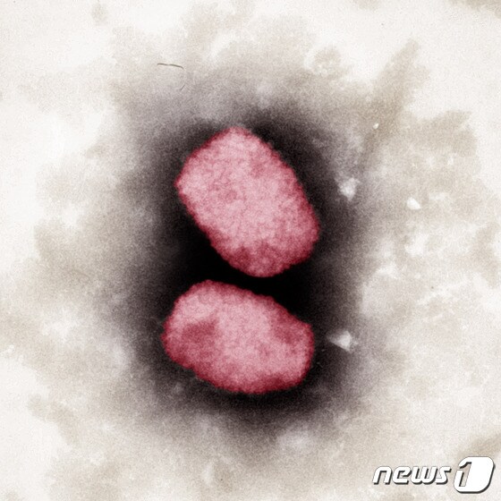 원숭이두창 바이러스를 유색 전자 현미경으로 포착한 사진을 독일 로버트코흐 연구소(RKI)가 공개했다. 2022. 5. 23. © AFP=뉴스1 © News1 최서윤 기자