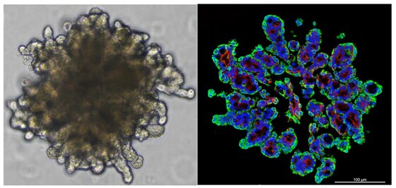 연구진이 침샘 상피줄기세포를 활용하여 배양에 성공한 3차원 오가노이드© 강남세브란스 제공
