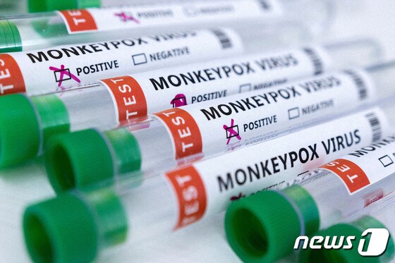 원숭이두창 관련 사진. © 로이터=뉴스1 © News1 이유진 기자