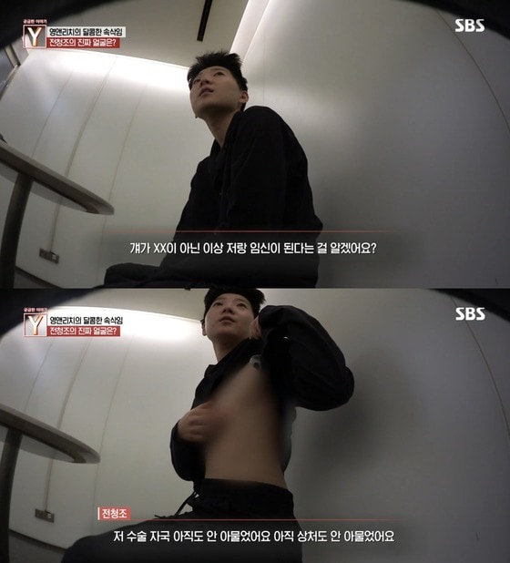 SBS '궁금한 이야기 Y'에서 전청조가 가슴 절제 수술을 주장하며 해당 부위를 보여주고 있다. (방송 화면 갈무리)