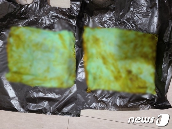 파킨슨 환자의 항문 안에서 발견된 배변매트 조각(독자 제공)2023.5.25/뉴스1 © News1 박아론 기자
