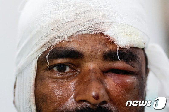 열차사고로 부상을 당한 나니 고팔 베리씨(38). © 로이터=뉴스1 © News1 박형기 기자