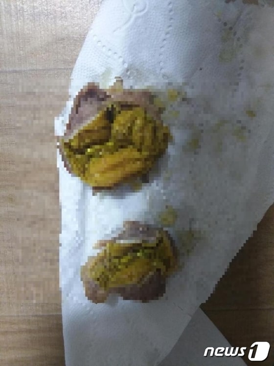 노란 이물질이 든 60계치킨 닭똥집 튀김.(온라인 커뮤니티 캡처)